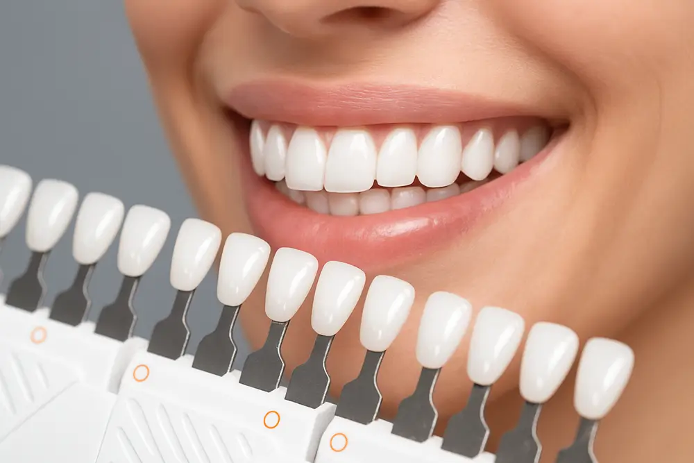 Coroane dentare zirconiu realizate prin tehnologia CAD CAM pentru un zâmbet natural și rezistent la Clinica Stomatologică Dentio Clinic București