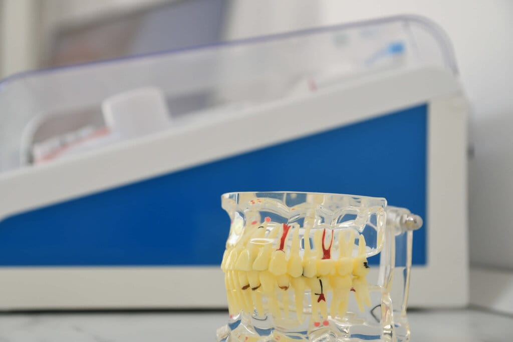 model-dentar-structura-implant-dentioclinic