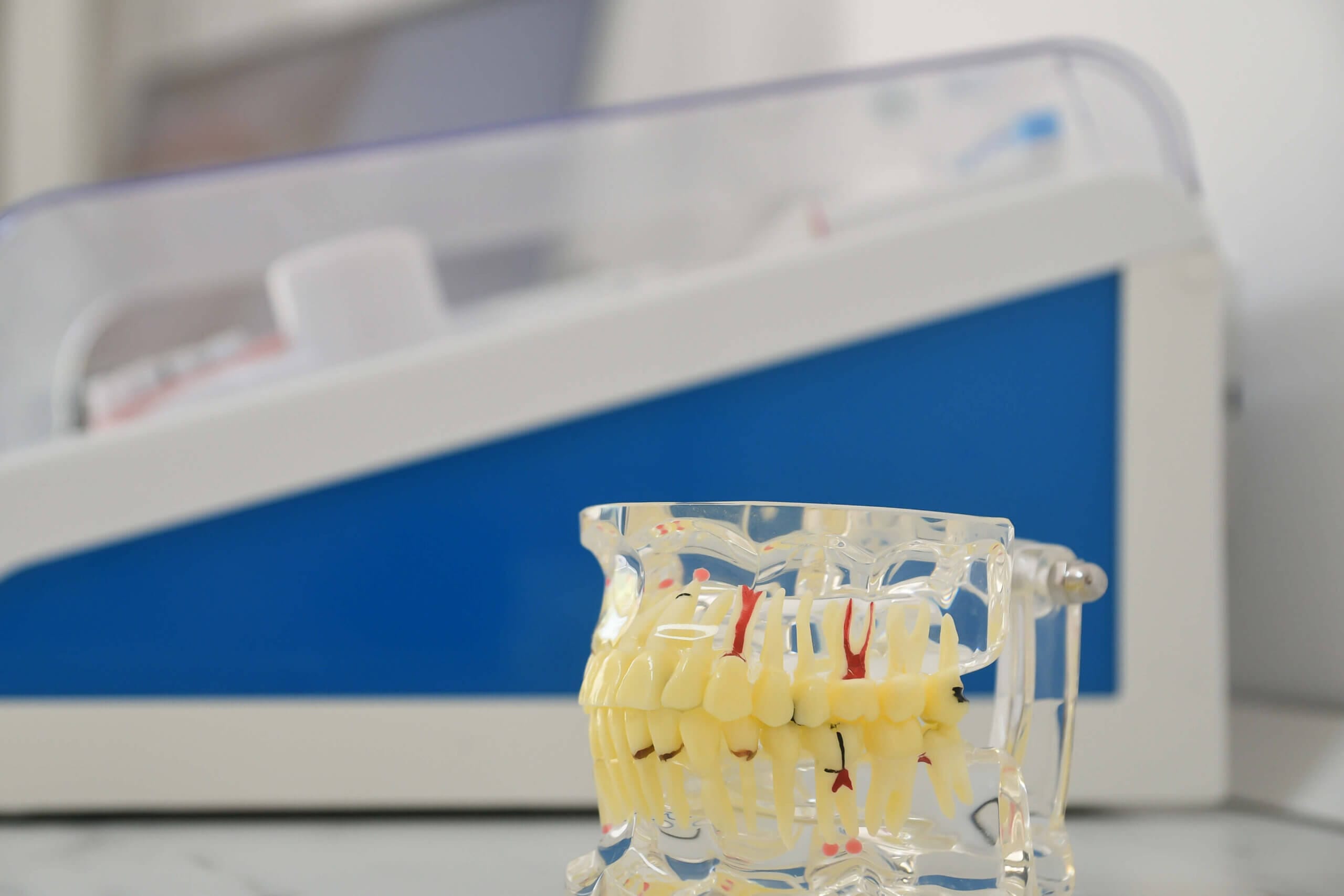 model-dentar-structura-implant-dentioclinic